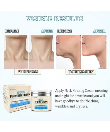 Kriloneal Neck Firming Cream - Anti-Wrinkle Anti-Aging Moisturizer with Hyaluronic Acid & Retinol for Tightening and Lifting Sagging Skin on Neck & Decolletage - Buy Online on GoSupps.com