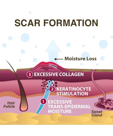Epi-Tabs Silicone Scar Sheets | 30 Clear Squares | 1.25x1.25 in | Biodermis - International Shipping - Buy Online on GoSupps.com