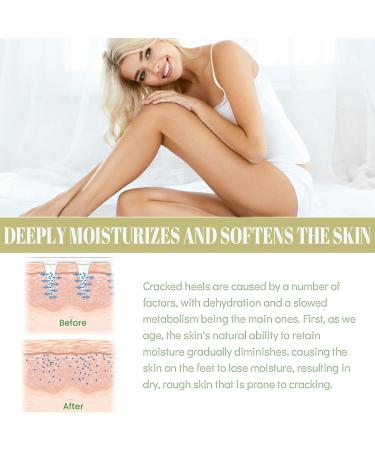 Honey Foot Cream Hand & Heel Cream for Very Dry Hands & Feet Foot Cream for Cracked Heels and Dry Skin Cracked Heel Repair Cream Foot Moisturiser Foot Care Products Cracked Heel Treatment Heel Cream - Buy Online on GoSupps.com