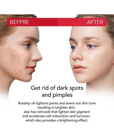 Rosehip Oil 60ML Organic Rosehip Seed Oil Anti-Aging Natural Cold Pressed Unrefined For Face Hair Nail Scar All Skin & Hair Typess - Buy Online on GoSupps.com