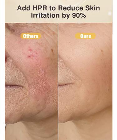 CiCi CareLabs Retinol Serum for Face - 1% HPR Anti-Wrinkle Formula for Visibly Smoother Skin - 1 Fl Oz - Buy Online on GoSupps.com