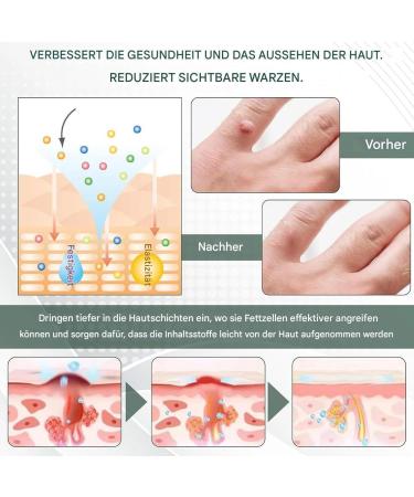 Duqulle Point Covering Face Cream Moisturizing Facial Care Naturally Moisturizing 50g Unisex Facial Water for Skin for Daily Use Smooth - Buy Online on GoSupps.com