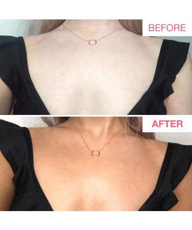 Bare by Vogue Self Tanning Lotion Dark-200 ml- Natural tanning Glow Moisturising Suitable for All Skin Types - Self Tanner for Face & Body. - Buy Online on GoSupps.com