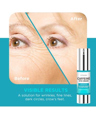 CITYGOO Snail Eye Stick for Dark Circles | Anti-Wrinkle Caffeine Eye Cream for Puffiness Treatment - Buy Online on GoSupps.com