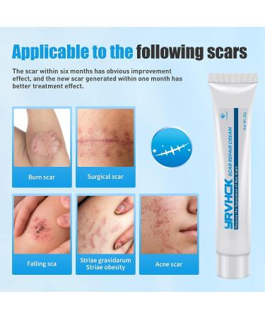 New Year Promotion: Scar Cream for Face and Body Repair - Reduces Surgery and C-Section Scars - 0.7 oz - Buy Online on GoSupps.com