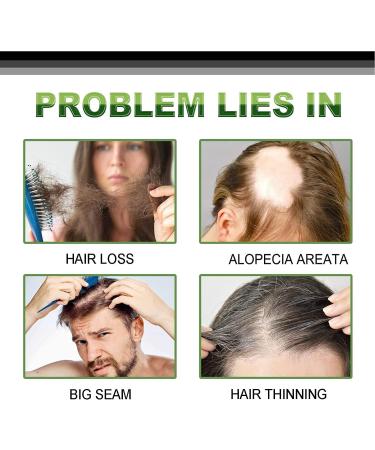 Anshka Silvercare Hair Care Eyebrow Essence AntiDropping Nutri Hair Care Eyebrow Essence Moisturizing Dense Hair Essence for Dry Damaged Hair & Growth 1pc - Buy Online on GoSupps.com