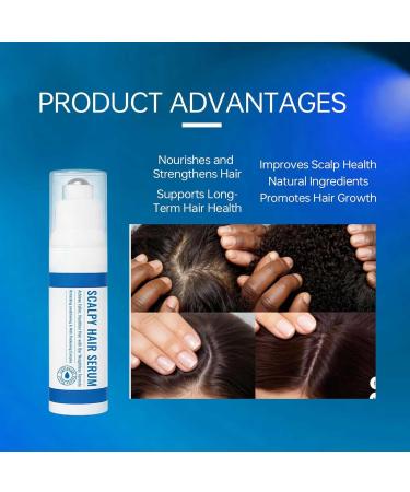  Zasdvn Hair Oil | 15ml Natural Scalp Care Roll-On Liquid Hair Growth Oil | To Restore Thickness And Volume For Men And Women - Buy Online on GoSupps.com