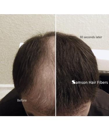 Refill kit Hair Fiber By Samson XLarge 50 Grams Hide Hair Loss and Hair Transplant Natural Looking Results Made in USA Hair Loss Concealer (Dark Brown) - Buy Online on GoSupps.com