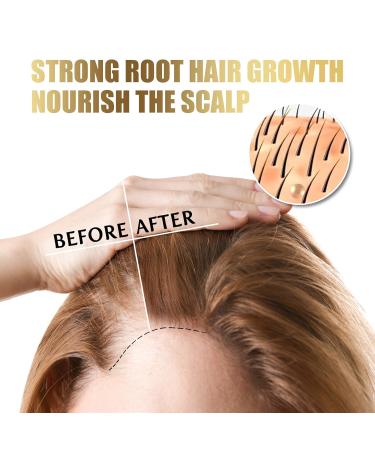 50g Hair Scalp Exfoliating Scrub Anti Hair Loss Treatment for Dandruff Flakes & Oily Scalp Nourishes Hair Follicles & Promotes Thicker Healthier Hair Growth - Buy Online on GoSupps.com
