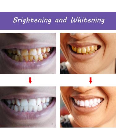 Buy GFOUK Oral Crystal Cleansing Mousse - Tooth Whitening & Purple Color Corrector Booster for Fresh Breath (2PCs) - International Shipping Available - Buy Online on GoSupps.com