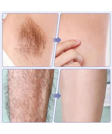 Permanent & Painless Hair Removal Device with Ice Cooling System - International Shipping Available - Buy Online on GoSupps.com