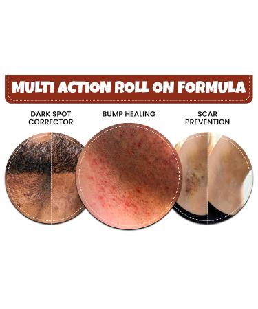 BUMP Terminator: Fast Acting Alcohol-Based Treatment for Razor Bumps & Ingrown Hairs - Unisex Roll-On for Face Neck Bikini Legs & Back - 3.05 oz - Buy Online on GoSupps.com