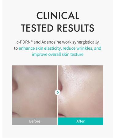 REJURAN Turnover Skincare Set with c-PDRN Salmon DNA Face Serum & Sheet Mask Duo for Firming Hydrating and Radiant Glass Skin Korean Anti-Aging Ampoule & Mask (1.69 fl oz + 5 Masks) - Buy Online on GoSupps.com