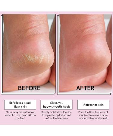Award-Winning Foot Peeling Mask - Dr. Pedicure Foot Peel Masks (4 Pairs Lavender) - Moisturizing Foot Masks That Remove Dead Skin Exfoliating Foot Mask for Dry Cracked Feet Feet Peeling Mask Lavender 1 count (Pack of 4) - Buy Online on GoSupps.com