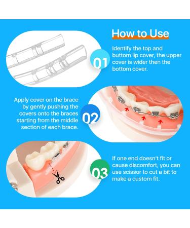 AIM DENTAL SUPPLY Lip Protector for Braces - Orthodontic Pain-Relief Mouth Guard - Custom-Fit Brace Covers - 2.0 Count - Buy Online on GoSupps.com