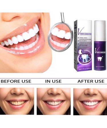 V34 Purple Toothpaste - Teeth Whitening & Bleaching Foam - 30ml Lightening Solution for Bright Smiles - Buy Online on GoSupps.com