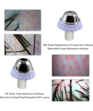 Skin Diagnosis Hair Analyzer 11 Inch LCD Screen Digital Scalp Hair Follicle Oil Moisture Magnifying Detector Analyzer Skin Pigment Tester - Buy Online on GoSupps.com