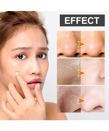 Xoermioy Purifying Balancing Massage Cream All-Natural Deep Cleansing & Exfoliating Face Cream Set (3 PCs) for Relaxation & Pore Cleansing - Buy Online on GoSupps.com
