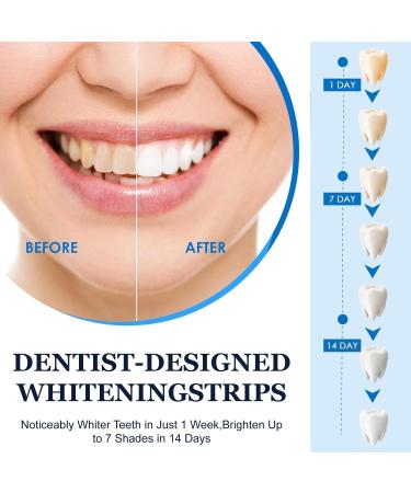 Blanchiment Dentaire 7 Pi ces Saveur menthe Bandes de Blanchiment Instantan white bande blanchissante Sans danger pour l' mail Haleine Fra che pour les Dents Aide Eliminer Caf Soda vin Tache - Buy Online on GoSupps.com