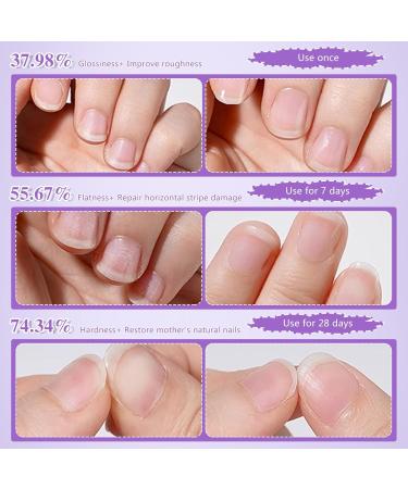 Stylo huile pour ongles 2 en 1 - Repousse-cuticules avec pointe en c ramique pour ongles secs et endommag s - Soin intensif et renforcement de la structure de l'ongle - Buy Online on GoSupps.com