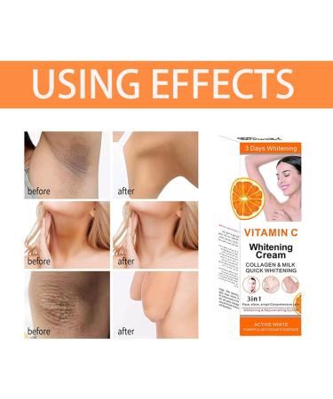 Vitamin C Armpit Whitening Cream Underarm Whitening Products For Body Whitening Skin Whitening Cream Skin Lightening Cream Melanin Removal For Underarms Armpit Knees Legs And Inner Thigh - Buy Online on GoSupps.com