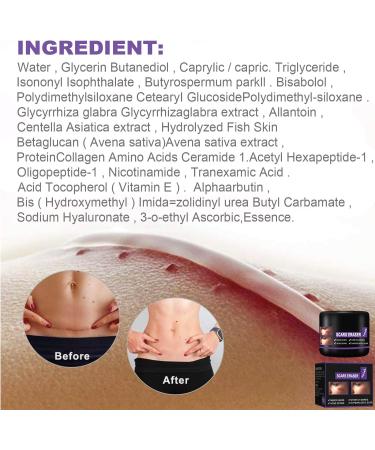 Scar Removal Cream 50ml - C-Section Skin Repair, Stretch Marks & Acne Surgery Treatment - Buy Online on GoSupps.com