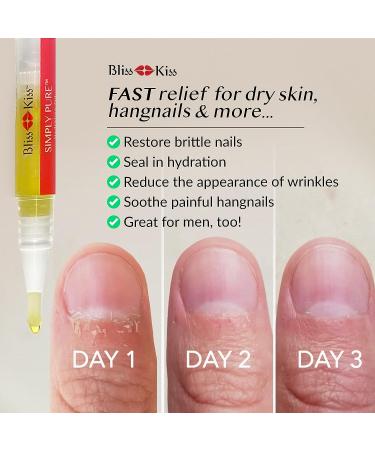 Bliss Kiss Crisp Fragrance Nail Oil Cuticle Pen with Vitamin E & Jojoba - Nail Strengthener and Growth Treatment - Buy Online on GoSupps.com