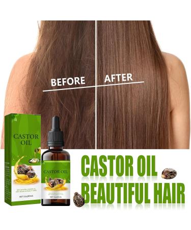 Castor Hair Oil for Hair and Scalp 60 ml Hair Oil Against Hair Loss to Stimulate Hair Growth and Care of the Scalp with Castor Oil Hair Oil Stimulates Hair Growth - Buy Online on GoSupps.com