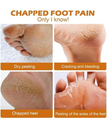 Horse Oil Foot Callus Balm Moisturizing Foot Cream Cream for Dry Cracked Heels Horse Oil Foot Cream Making It Smoother and P - Buy Online on GoSupps.com