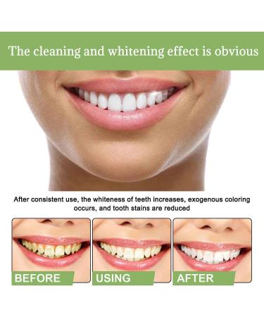 Anti-Dark Tlopa Ampoule Toothpaste & Essence - 3V Fruit Acid Tooth Whitening Serum | 20 Disposable Tartar Removal Treatments - Buy Online on GoSupps.com