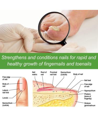Keratin 3 Day Growth Nail Treatment & Strengthener Nail Growth and Strengthener Fast Keratin Nail Hardener Nail Hardener Oil Nail Polish Strengthener for Thin Nails Nail Strengthener for Damaged Nails - Buy Online on GoSupps.com