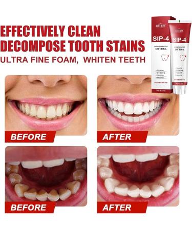 -4 Whitening Toothpaste -4 Teeth Whitening Toothpaste Fresh Breath Toothpaste 4 All Smiles Brightening and Stain-Removing Toothpaste Cream -4 Anti-Stain Toothpaste - Buy Online on GoSupps.com