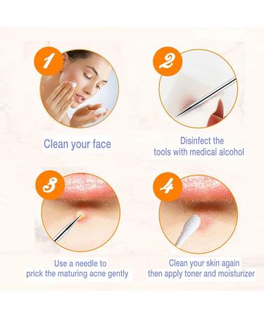 Blackhead Remover Kit Curved Tweezer Blackhead Removal Tools Spot Remover Tools Professional Pimple Comedone Extractor Zit Popper for Nose Face (silver) - Buy Online on GoSupps.com
