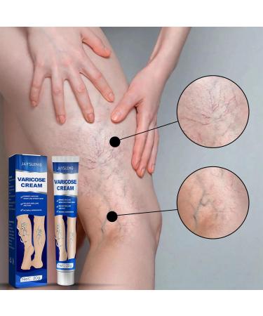 Natural Varicose Veins Relief Cream for Legs - Spider Vein & Varicose Vein Treatment - Buy Online on GoSupps.com