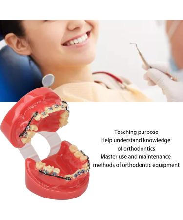 Orthodontic Bracket Model - 24 Teeth Demonstration Model with Metal Wires & Brackets for Dental Education - Buy Online on GoSupps.com