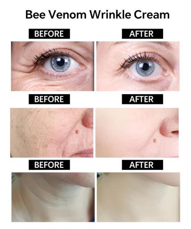BotoxCream BotoxBee Venom Wrinkle Removal Cream Anti-Aging Firming Lifting and Moisturizing Skin Cream for All Skin Types Recovery and Anti-Wrinkle Care (Bee) yellow - Buy Online on GoSupps.com