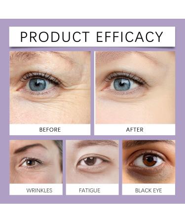 NHIGINPH Eye Cream for Dark Circles and Puffiness Anti-Aging Under Eye Treatment with Hyaluronic Acid Peptides Firms Brightens Smooths Fine Lines 1 Oz - Buy Online on GoSupps.com