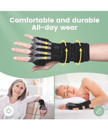 Radial Nerve Palsy Brace - Adjustable Splint for Finger Extension & Wrist Drop | Recovery Support for Crutch Palsy Stroke MCP Arthroplasty - Buy Online on GoSupps.com