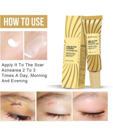 Yuemei Scar Vanishing Cream - Strengthen Skin Repair, Remove Old Scars & Stretch Marks | Suitable for All Skin Types - Buy Online on GoSupps.com