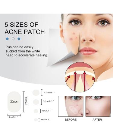 Pimple Patches Acne Stickers Hydrocolloid Patches Large Acne Stickers for Face Chin or Body Effectively Calms & Relieves Acne (80 Patches) - Buy Online on GoSupps.com