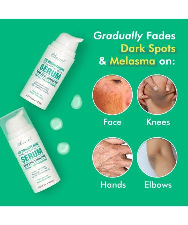 Dark Spot Remover Serum for Face - Skin Lightening & Brightening Treatment | Melasma, Hyperpigmentation & Sun Spot Remover with Synovea, 4-Butylresorcinol, Niacinamide & Kojic Acid - Buy Online on GoSupps.com