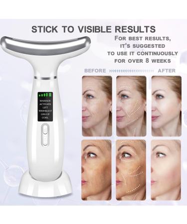 Youngfocus Face-Neck Massager - Vibration & Cooling Red Light Therapy for Anti-Aging & Skin Tightening - White - Buy Online on GoSupps.com
