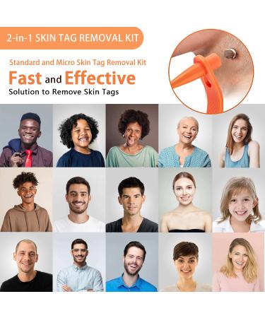 MEIJU Skin Tag Removers | 2-in-1 Removal Kit for Small to Large Skin Tags | Easy Application Device with 36 Repair Patches - Yellow - Buy Online on GoSupps.com