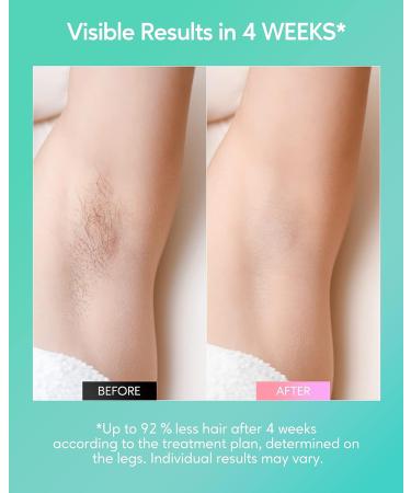 IPL Hair Removal Device for Women and Men - Permanent Hair Remover Machine - 10 Energy Levels - INNZA Hair Removal Handset - Face, Bikini Line, Armpit, Leg, Back - Corded - 24J High Energy - Buy Online on GoSupps.com