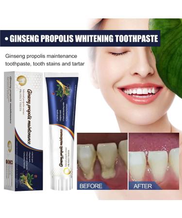 Koahde Tooth Removal Toothpaste | Propolis Care & Brightening for Yellow Teeth | Deep Cleaning Day & Night Formula - Buy Online on GoSupps.com