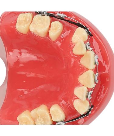 Orthodontic Demonstration Model | Professional Dental Model with Metal Wires & Brackets for Learning | International Shipping Available - Buy Online on GoSupps.com