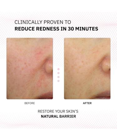 Physiogel Calming Relief Lotion | Reduces Redness in 30 Mins | Moisturizer for Dry Sensitive Skin | Fragrance-Free Face Cream for Men & Women 13.5 fl. Oz - Buy Online on GoSupps.com