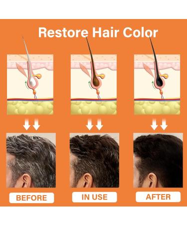 Herbal Gray Hair Reverse Spray | Smoothing Darkening & Growth Serum for Thinning Hair | Polygonum Multiflorum Conditioner for Men & Women - Buy Online on GoSupps.com