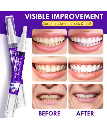 Purple Teeth Whitening Pen 6PCS Teeth Whitening Gel Essence Gentle Formula No Sensitivity Snow Teeth Whitener Gel Kit for a Brighter Smile - Buy Online on GoSupps.com