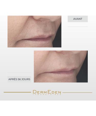 Laboratoires DermEden Duo Fermet et Collag ne - Concentr R tinal et Cr me Nuit - Fabrication Fran aise - Buy Online on GoSupps.com